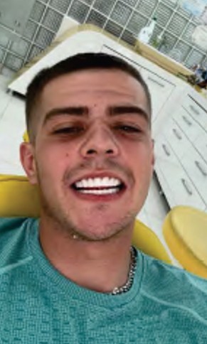 Corran Davies Teeth.jpg